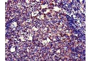 Immunohistochemistry of paraffin-embedded human tonsil tissue using ABIN7150247 at dilution of 1:100 (POLH antibody  (AA 408-609))
