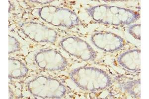 Immunohistochemistry of paraffin-embedded human colon tissue using ABIN7164641 at dilution of 1:100 (GLT25D2 antibody  (AA 351-626))