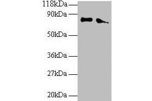 Western blot All lanes: ERP29 antibody at 2 μg/mL Lane 1: EC109 whole cell lysate Lane 2: 293T whole cell lysate Secondary Goat polyclonal to rabbit IgG at 1/15000 dilution Predicted band size: 29, 6 kDa Observed band size: 80 kDa (ERP29 antibody  (AA 40-251))