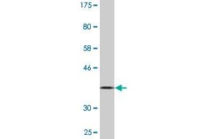 Western Blot detection against Immunogen (36. (Calpain 3 antibody  (AA 210-309))