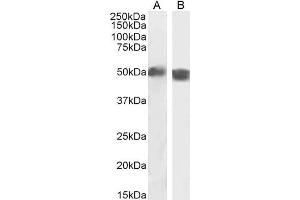 ABIN190840 (2µg/ml) staining of Human Spleen (A) and Mouse Thymus (B) lysate (35µg protein in RIPA buffer). (Carabin antibody  (Internal Region))