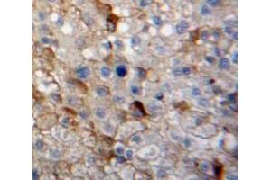 Used in DAB staining on fromalin fixed paraffin-embedded Liver tissue (GAP43 antibody  (AA 8-228))