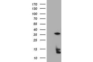 Image no. 5 for anti-Thymidylate Synthetase (TYMS) antibody (ABIN1501591) (TYMS antibody)