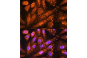 Immunofluorescence analysis of H9C2 cells using PSMD4 Rabbit pAb (ABIN3021329, ABIN3021330, ABIN3021331 and ABIN6214913) at dilution of 1:100. (PSMD4/ASF antibody  (AA 1-377))