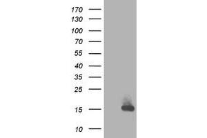 HEK293T cells were transfected with the pCMV6-ENTRY control (Left lane) or pCMV6-ENTRY RBP1 (Right lane) cDNA for 48 hrs and lysed. (RBP1 antibody)