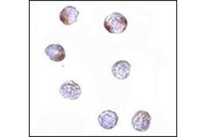 Immunocytochemistry of KLHL15 in HeLa cells with this product at 5 μg/ml. (KLHL15 antibody  (C-Term))