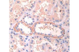 Used in DAB staining on fromalin fixed paraffin- embedded kidney tissue (LIFR antibody  (AA 692-833))