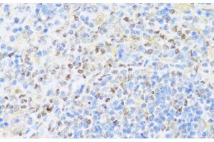 Immunohistochemistry of paraffin-embedded Rat spleen using UQCC2 Polyclonal Antibody at dilution of 1:100 (40x lens). (MNF1 antibody)