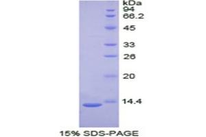 SDS-PAGE (SDS) image for Plasminogen Activator, Tissue (PLAT) (AA 36-126) protein (His tag) (ABIN2121902) (PLAT Protein (AA 36-126) (His tag))