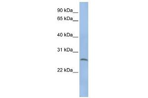 Elastase 1 antibody (Pancreatic) used at 1 ug/ml to detect target protein.