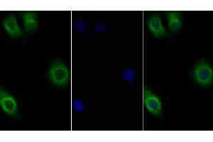 Detection of IL10Rb in Human Hela cell using Polyclonal Antibody to Interleukin 10 Receptor Beta (IL10Rb) (IL10RB antibody  (AA 87-243))