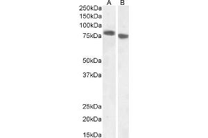 (ABIN238631) (1 μg/mL) staining of A431 (A) and (0. (EPB41L5 antibody  (Internal Region))