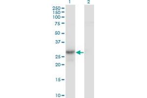 Western Blot analysis of GMNN expression in transfected 293T cell line by GMNN monoclonal antibody (M01), clone 1A8. (Geminin antibody  (AA 110-209))