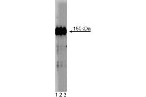 Western blot analysis of CD49e (Integrin alpha5) on a HeLa cell lysate (Human cervical epitheloid carcinoma, ATCC CCL-2.