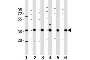 Western blot testing of MICA antibody at 1:2000 dilution.