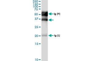 Immunoprecipitation of SULT2B1 transfected lysate using anti-SULT2B1 MaxPab rabbit polyclonal antibody and Protein A Magnetic Bead , and immunoblotted with SULT2B1 MaxPab rabbit polyclonal antibody (D01) . (SULT2B1 antibody  (AA 1-365))