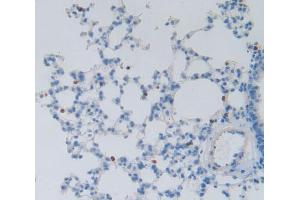 Used in DAB staining on fromalin fixed paraffin- embedded Kidney tissue (DFFA antibody  (AA 19-262))