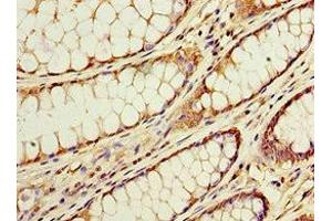 ACSM3 antibody  (AA 387-586)