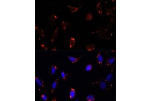 Immunofluorescence analysis of U-2 OS cells using TBRG4 antibody  at dilution of 1:100. (TBRG4 antibody  (AA 382-631))