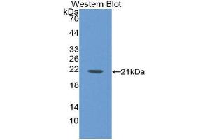 Western Blotting (WB) image for anti-Laminin, beta 2 (Laminin S) (LAMB2) (AA 75-223) antibody (ABIN1868908) (LAMB2 antibody  (AA 75-223))