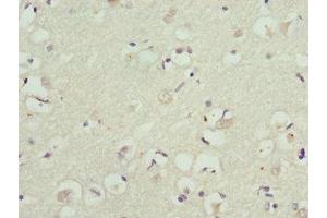 Immunohistochemistry of paraffin-embedded human brain tissue using ABIN7157744 at dilution of 1:100 (KCNIP2 antibody  (AA 1-90))