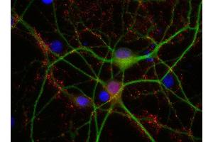 Indirect immunostaining of PFA fixed rat hippocampus neurons with anti-synaptogyrin 1 (dilution 1 : 500; red) and mouse anti-MAP 2 (cat. (Synaptogyrin 1 antibody)