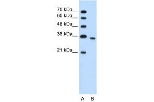 WB Suggested Anti-PRPS2  Antibody Titration: 1. (PRPS2 antibody  (N-Term))