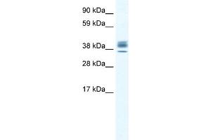WB Suggested Anti-ESX1 Antibody Titration:  2. (ESX Homeobox 1 antibody  (N-Term))