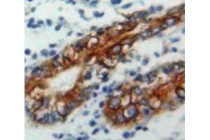 IHC-P analysis of Stomach tissue, with DAB staining. (CD79a antibody  (AA 36-219))