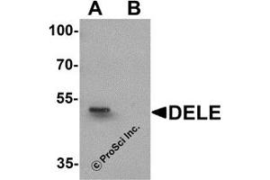 Western Blotting (WB) image for anti-DAP3 Binding Cell Death Enhancer 1 (DELE1) (N-Term) antibody (ABIN1031350) (DELE1/KIAA0141 antibody  (N-Term))