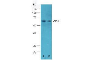 Lane A: Mouse Heart lysate Lane B: Mouse Pancreas lysates probed with Rabbit Anti-API5 Polyclonal Antibody, Unconjugated (ABIN673959) at 1:300 overnight at 4 °C. (Apoptosis Inhibitor 5 antibody  (AA 351-460))