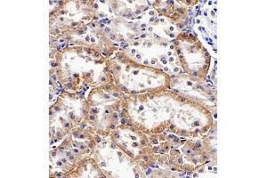 Immunohistochemistry (Paraffin-embedded Sections) (IHC (p)) image for anti-Linker For Activation of T Cells Family, Member 2 (LAT2) antibody (ABIN7074503)