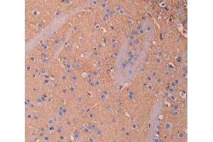 IHC-P analysis of brain tissue, with DAB staining. (IL18BP antibody  (AA 29-193))