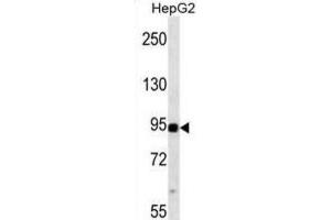 Western Blotting (WB) image for anti-Mitogen-Activated Protein Kinase Kinase Kinase 11 (MAP3K11) antibody (ABIN2938456) (MAP3K11 antibody)