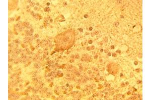 Image no. 1 for anti-Sphingolipid Delta(4)-Desaturase DES1 (DEGS1) antibody (ABIN793733) (DEGS1 antibody)