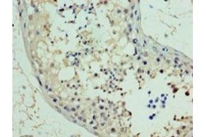 Immunohistochemistry of paraffin-embedded human testis tissue using PA889102LA01HU at dilution of 1:100 (RAD18 antibody  (AA 1-495))