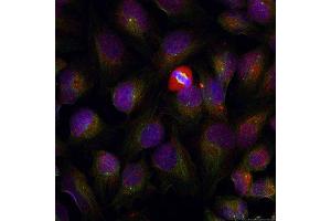 Immunofluorescence staining of methanol-fixed HeLa cells using Phospho-NFKB1-S337 antibody (ABIN2987371). (NFKB1 antibody  (pSer337))