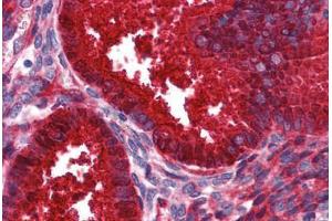 Human Uterus: Formalin-Fixed, Paraffin-Embedded (FFPE) (SERPING1 antibody  (AA 1-501))