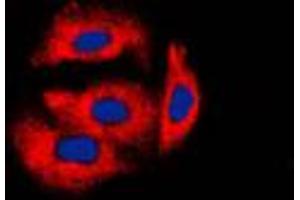Immunofluorescence (IF) image for anti-Cytochrome B5 Type A (Microsomal) (CYB5A) (Center) antibody (ABIN7295426)