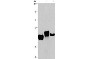 Gel: 6 % SDS-PAGE, Lysate: 40 μg, Lane 1-3: Human placenta tissue, Human fetal liver tissue, HepG2 cells, Primary antibody: ABIN7192345(SGK2 Antibody) at dilution 1/100, Secondary antibody: Goat anti rabbit IgG at 1/8000 dilution, Exposure time: 8 minutes (SGK2 antibody)