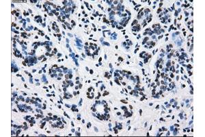 Immunohistochemical staining of paraffin-embedded breast tissue using anti-L1CAM mouse monoclonal antibody. (L1CAM antibody)