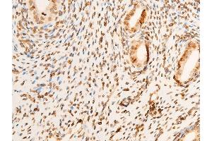 Immunohistochemistry (IHC) image for anti-Eukaryotic Translation Initiation Factor 2 Subunit 1 (EIF2S1) (pSer51) antibody (ABIN6255389)