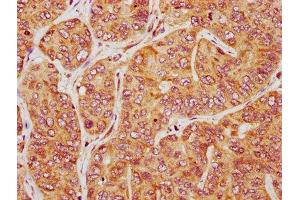 Immunohistochemistry (IHC) image for anti-Phosphoinositide-Interacting Regulator of Transient Receptor Potential Channels (PIRT) (AA 1-55) antibody (ABIN7163307)