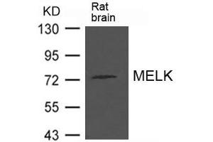 Western blot analysis of extract from Rat brain tissue using MELK Antibody (MELK antibody)