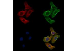 ABIN6258242 and ABIN6275903 staining Hela cells by IF/ICC.