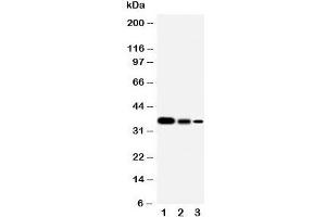 Western Blotting (WB) image for anti-SHC (Src Homology 2 Domain Containing) Transforming Protein 1 (SHC1) (C-Term) antibody (ABIN3032555)