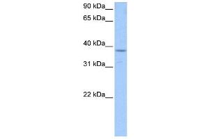 PCBP1 antibody used at 1 ug/ml to detect target protein. (PCBP1 antibody)