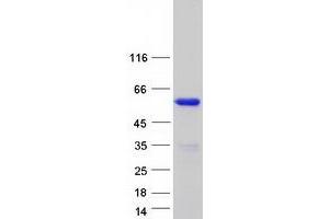 Validation with Western Blot (DOC2B Protein (Myc-DYKDDDDK Tag))