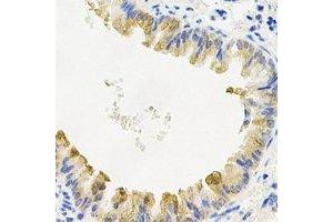 Immunohistochemical analysis of COQ7 staining in mouse lung formalin fixed paraffin embedded tissue section.