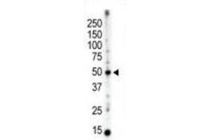 Western Blotting (WB) image for anti-Protein Kinase C and Casein Kinase Substrate in Neurons 3 (PACSIN3) antibody (ABIN3003676)